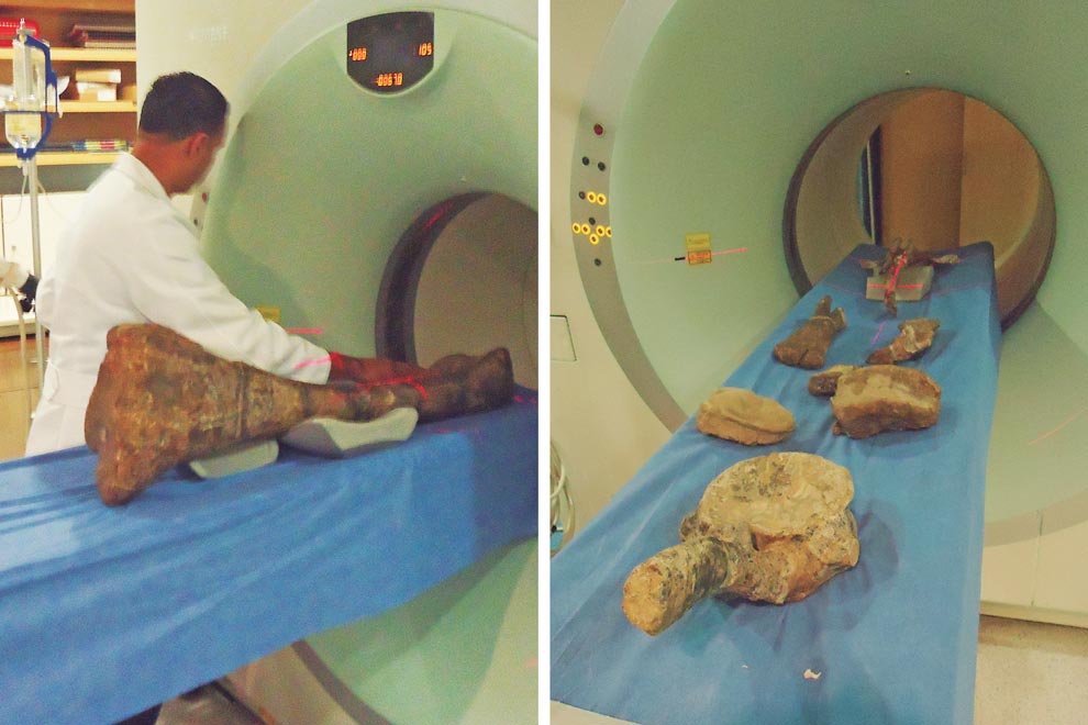 Análisis de diversos huesos en el tomógrafo de la Unidad PET-CT de la Facultad de Medicina. Fotos: cortesía de Ángel Alejandro Ramírez.