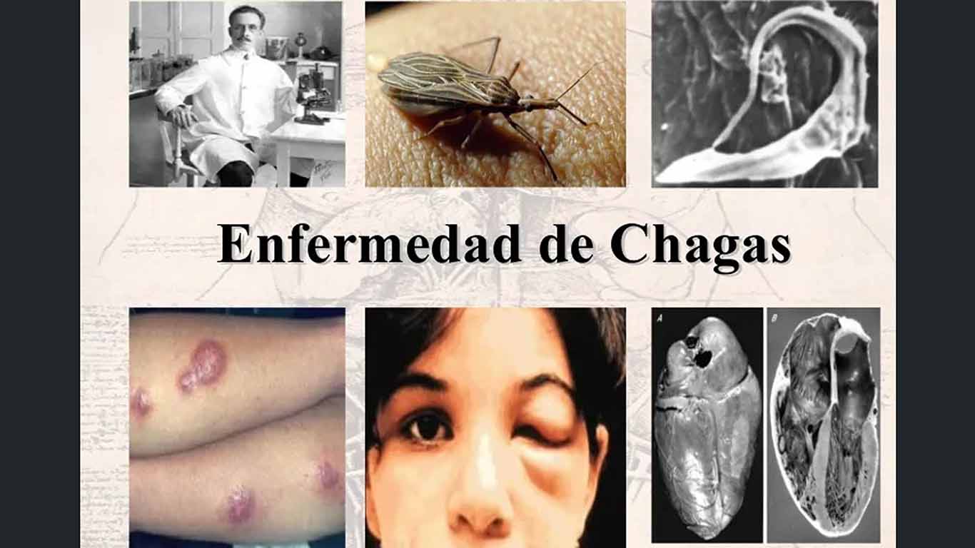 Riesgo de Chagas. 